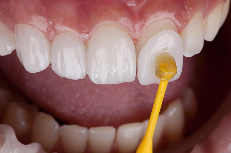 Jamacha Dental Special Offer