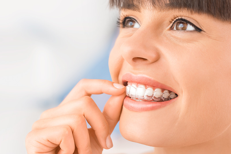 Dental Treatments in El Cajon